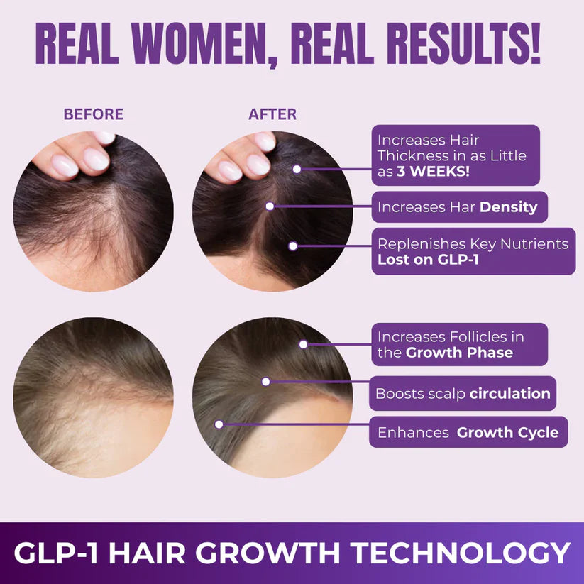 Take Control of Hair Loss Naturally