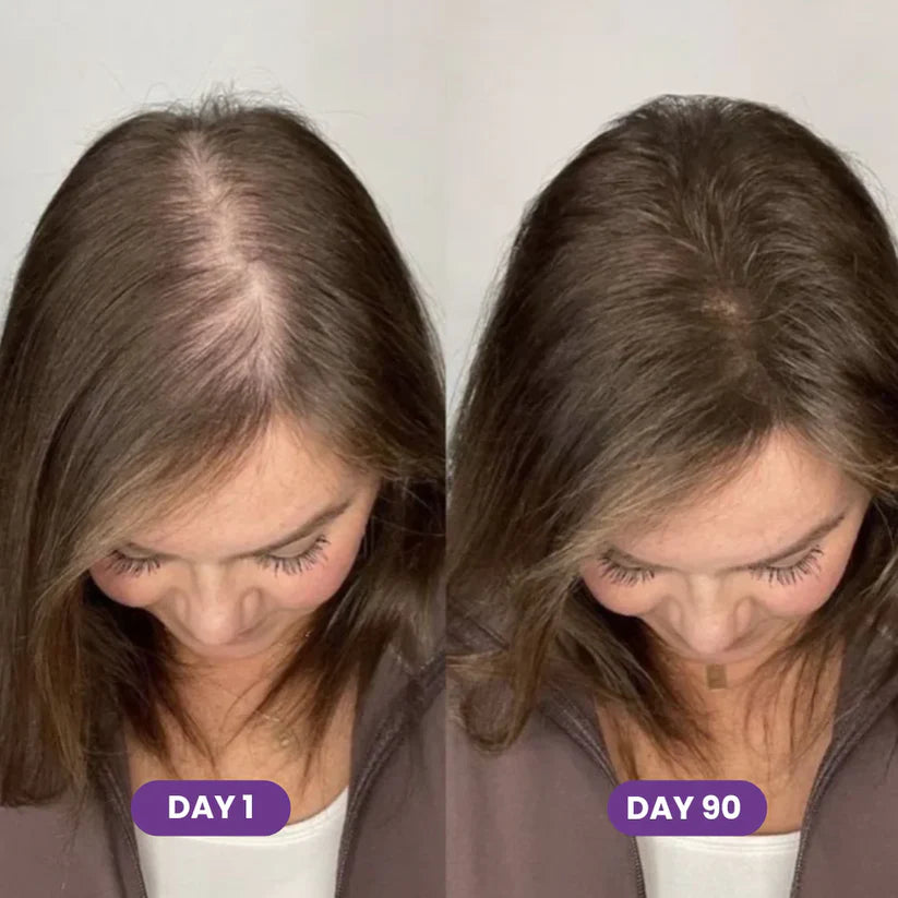 Take Control of Hair Loss Naturally