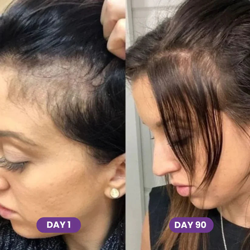 Take Control of Hair Loss Naturally
